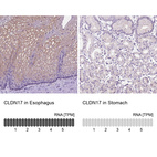 Anti-CLDN17 Antibody