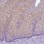 Immunohistochemical staining of human esophagus shows high expression.