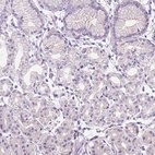 Immunohistochemical staining of human stomach shows low expression as expected.