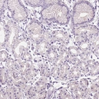 Immunohistochemical staining of human stomach shows low expression as expected.