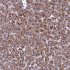 Anti-NSUN6 Antibody