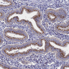 Immunohistochemical staining of human Endometrium shows strong granular cytoplasmic positivity in glandular cells.