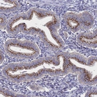 Immunohistochemical staining of human Endometrium shows strong granular cytoplasmic positivity in glandular cells.