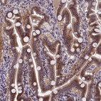 Immunohistochemical staining of human Duodenum shows strong granular cytoplasmic positivity in glandular cells.