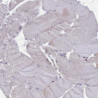 Immunohistochemical staining of human Skeletal muscle shows very weak granular cytoplasmic positivity in myocytes.