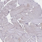 Immunohistochemical staining of human Skeletal muscle shows very weak granular cytoplasmic positivity in myocytes.
