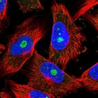 Immunofluorescent staining of human cell line U-251 MG shows localization to nucleoli.