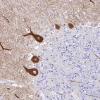 Immunohistochemical staining of human Cerebellum shows strong cytoplasmic positivity in Purkinje cells and neuronal processes.