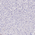 Anti-TAC3 Antibody