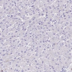 Immunohistochemical staining of human Liver shows no positivity in hepatocytes as expected.