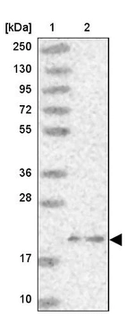 Lane 1: Marker [kDa] 250, 130, 95, 72, 55, 36, 28, 17, 10_br/_Lane 2: Human cell line RT-4