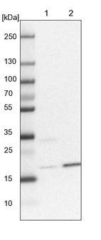 Lane 1: NIH-3T3 cell lysate (Mouse embryonic fibroblast cells)_br/_Lane 2: NBT-II cell lysate (Rat Wistar bladder tumour cells)