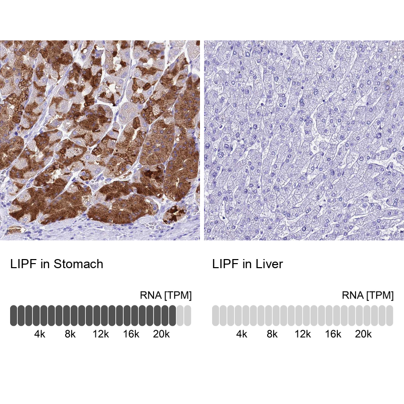 Anti-LIPF Antibody