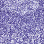 Immunohistochemical staining of human lymph node shows no positivity in non-germinal center cells as expected.