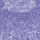 Immunohistochemical staining of human lymph node shows no positivity in non-germinal center cells as expected.