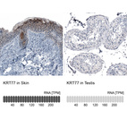 Anti-KRT77 Antibody