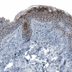Immunohistochemical staining of human skin shows weak to moderate cytoplasmic positivity in epidermal cells.