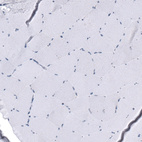 Immunohistochemical staining of human skeletal muscle shows no cytoplasmic positivity in monocytes as expected.
