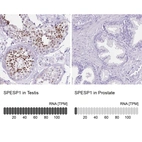 Anti-SPESP1 Antibody