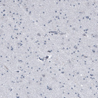 Immunohistochemical staining of human cerebral cortex shows no cytoplasmic positivity in neuronal cells as expected.