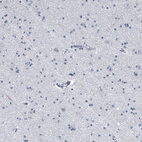 Anti-KRT77 Antibody