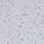Immunohistochemical staining of human cerebral cortex shows no cytoplasmic positivity in neuronal cells as expected.