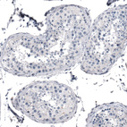 Anti-KRT77 Antibody