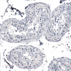 Immunohistochemical staining of human testis shows no cytoplasmic positivity in cells in seminiferous ducts as expected.