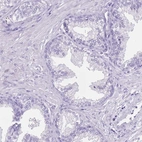 Immunohistochemical staining of human prostate shows low expression as expected.