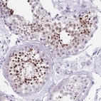 Immunohistochemical staining of human testis shows high expression.