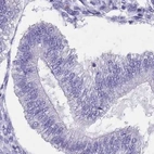 Immunohistochemical staining of human endometrium using Anti-SPESP1 antibody HPA045936.
