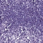 Immunohistochemical staining of human lymph node using Anti-SPESP1 antibody HPA045936.