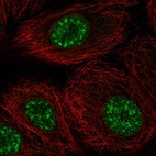 Anti-DAZAP2 Antibody