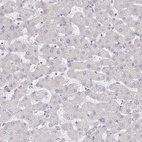 Anti-CXCR3 Antibody