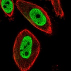 Immunofluorescent staining of human cell line PC-3 shows localization to nucleoplasm.