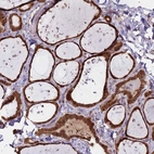 Anti-ASNA1 Antibody