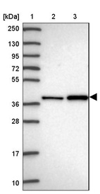 Lane 1: Marker [kDa] 250, 130, 95, 72, 55, 36, 28, 17, 10_br/_Lane 2: Human cell line RT-4_br/_Lane 3: Human cell line U-251MG sp