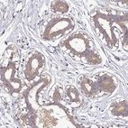 Immunohistochemical staining of human breast shows moderate cytoplasmic positivity in glandular cells.