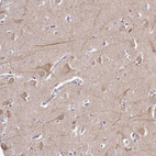 Immunohistochemical staining of human cerebral cortex shows weak cytoplasmic positivity in neurons.