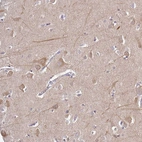 Immunohistochemical staining of human cerebral cortex shows weak cytoplasmic positivity in neurons.