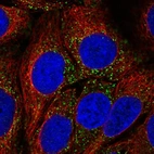 Immunofluorescent staining of human cell line CACO-2 shows localization to vesicles.