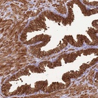 Anti-KLHL9 Antibody