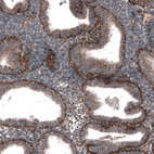 Anti-ZDHHC14 Antibody