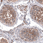 Anti-ZDHHC14 Antibody