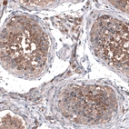 Immunohistochemical staining of human testis shows moderate cytoplasmic positivity in cells in seminiferous ducts.
