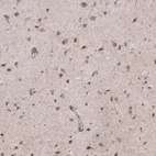 Immunohistochemical staining of human cerebral cortex shows moderate cytoplasmic positivity in neuronal cells.