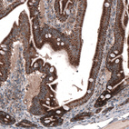 Anti-ZDHHC14 Antibody