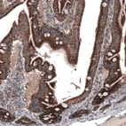 Immunohistochemical staining of human duodenum shows strong cytoplasmic positivity in glandular cells.