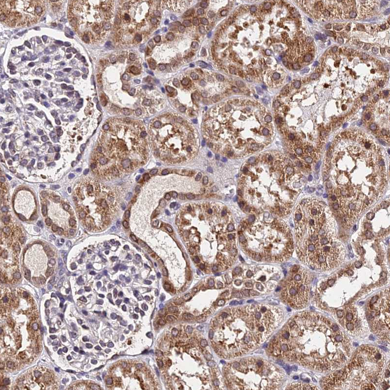 Anti-RNF121 Antibody