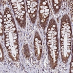 Immunohistochemical staining of human rectum shows strong cytoplasmic positivity in glandular cells.